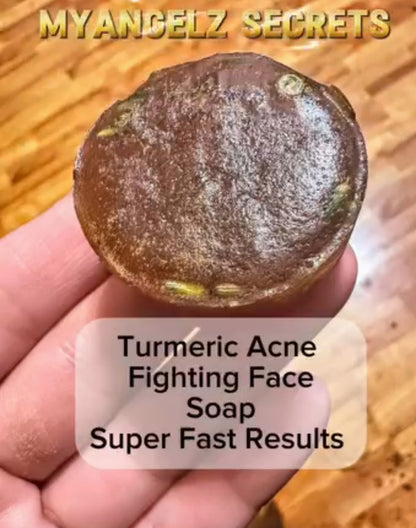 Turmeric Honey Acne Face Soap 🔥🧼